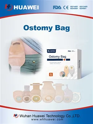 Ostomiya jarrohligidan keyin ich qotishi: xavfsiz boshqaruv bo'yicha to'liq q...